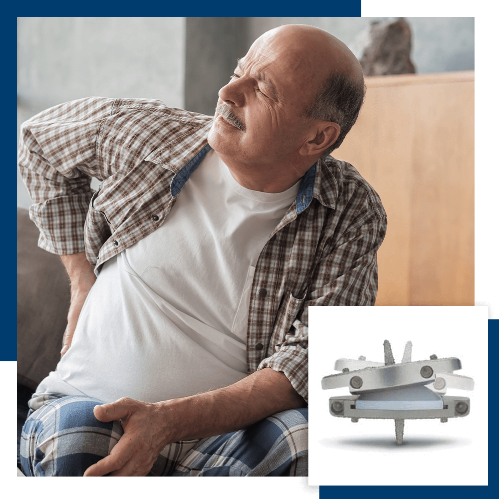 older man with back pain and a model of the Prodisc L