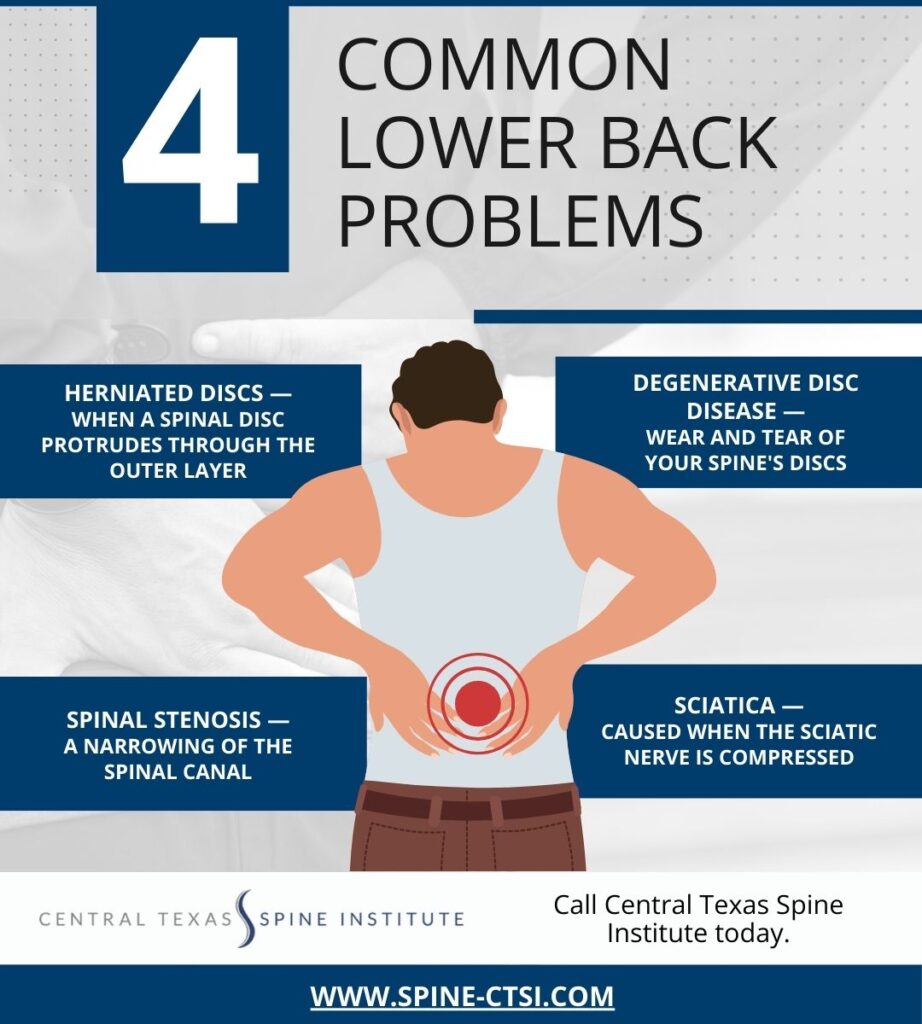 infographic about common lower back problems