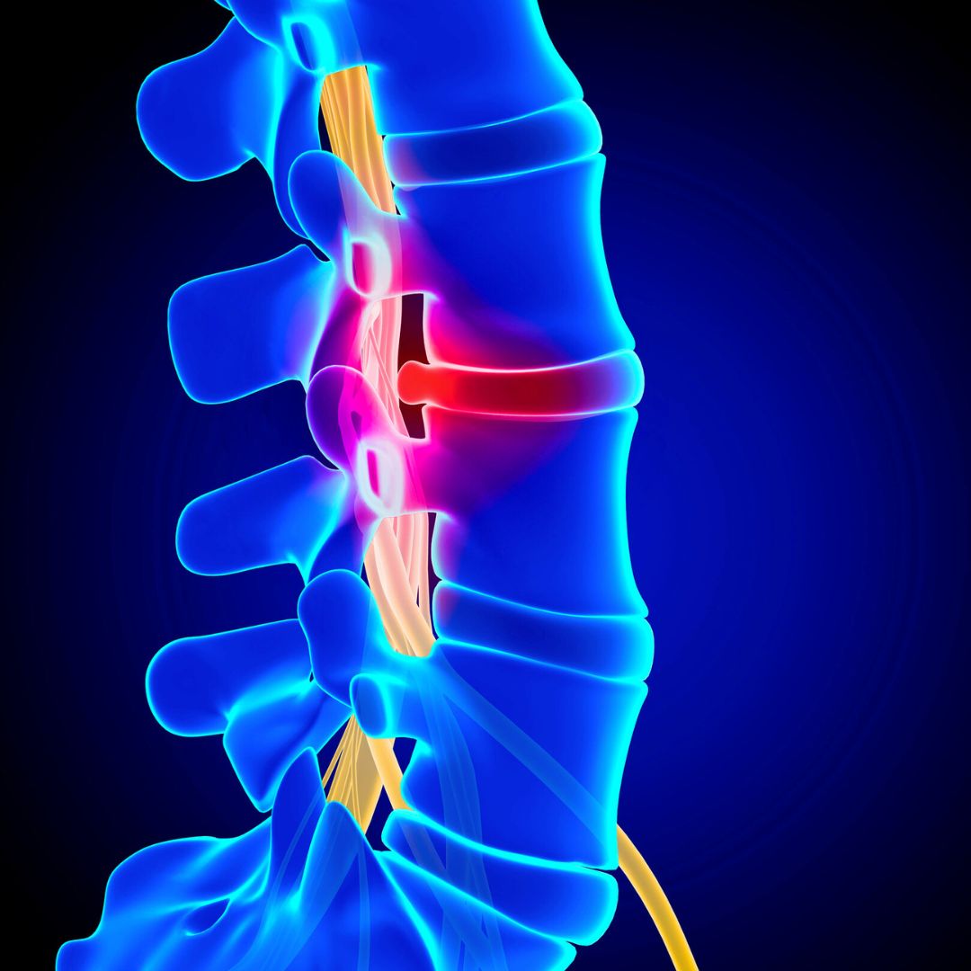 spine graphic